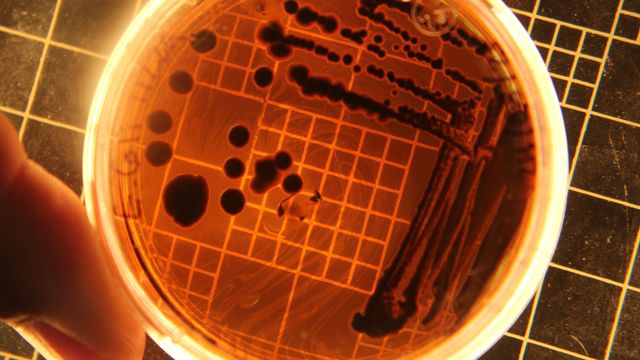 Escherichia coli (E. coli)