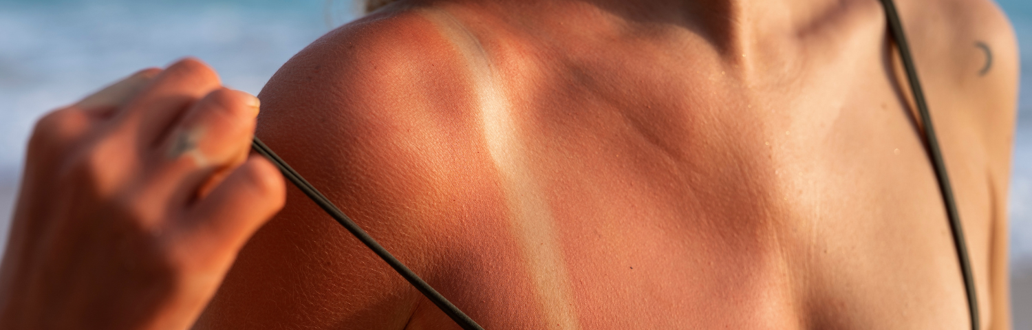 Tips to Prepare, Protect and Restore Skin After Sun Exposure
