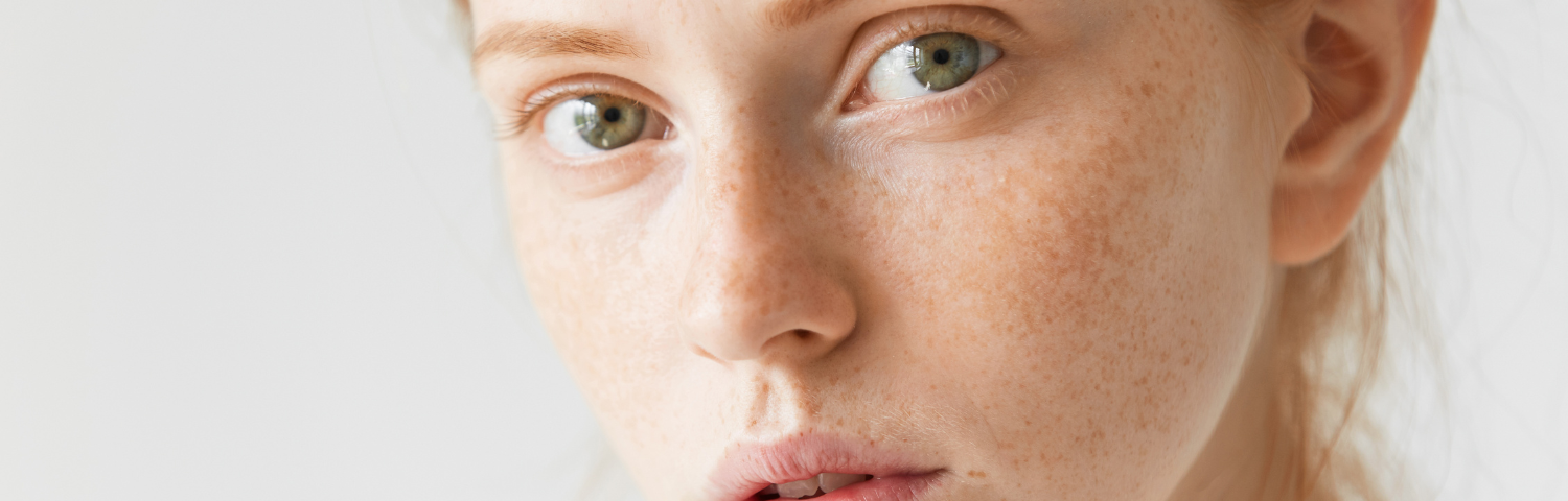 Neoretin Discrom serum for treating dark spots