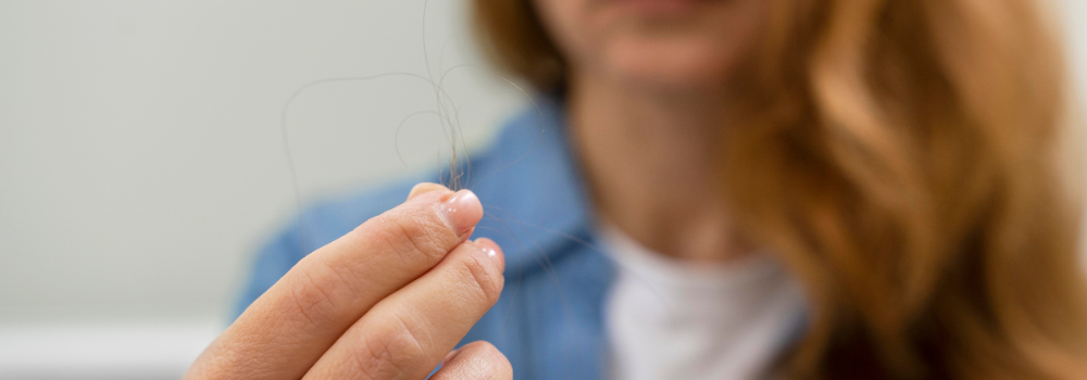 Hair loss after summer: pharmacy tips and treatments