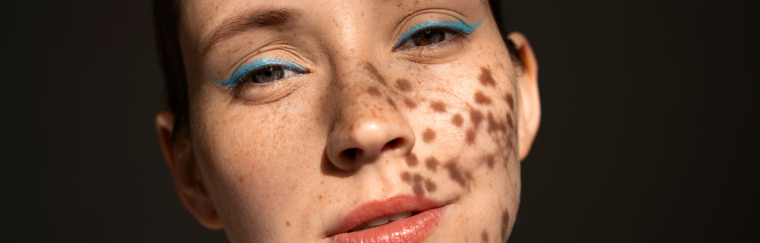 Facial Dark Spots: What Causes Them?