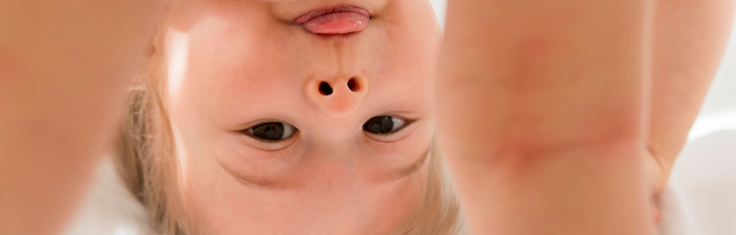 Atopic dermatitis in children
