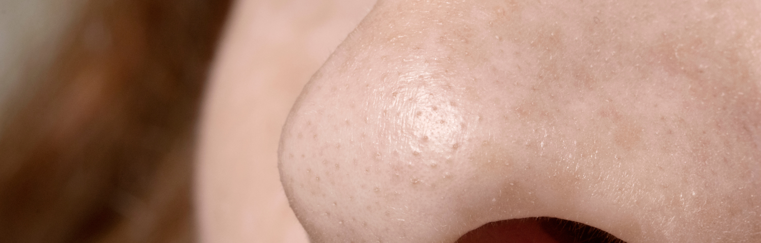 Skin pores: why they don't close