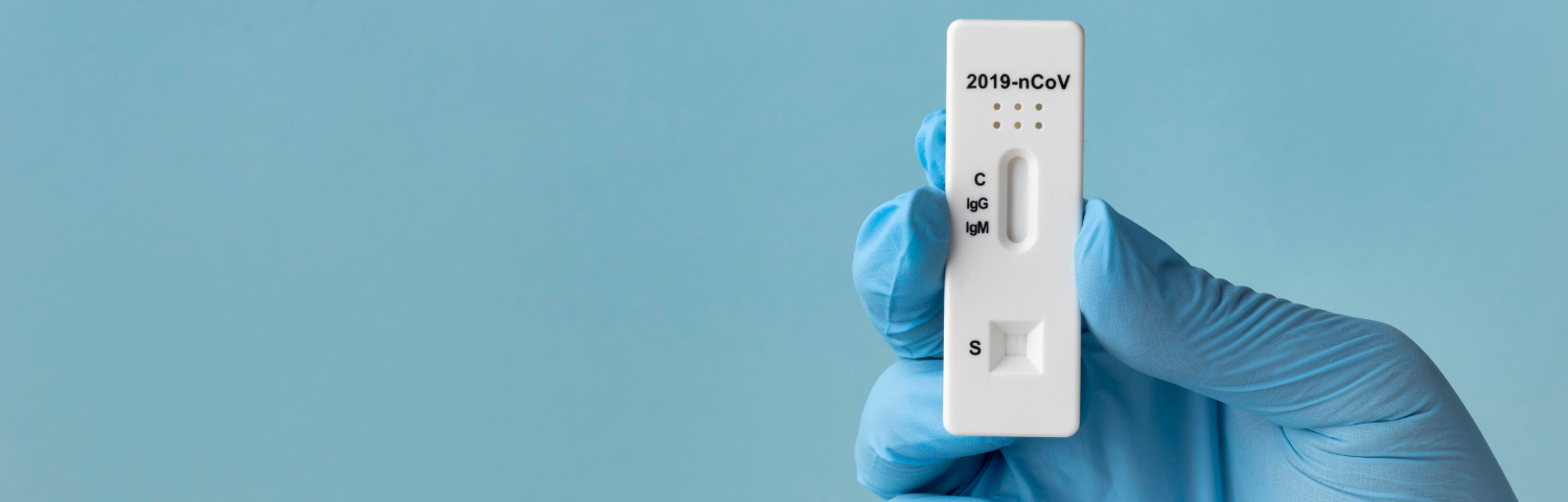COVID-19 and Flu Test: When Should It Be Taken and How Should the Results Be Interpreted?