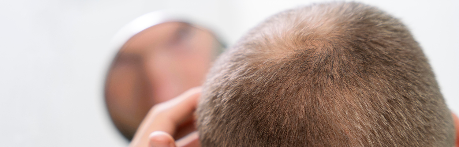 Causes of hair loss and the effect of cystine