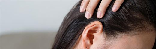 What to take for postpartum hair loss