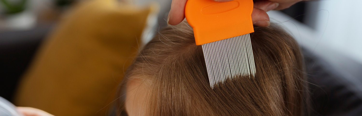Products and tips to remove head lice and nits at home effectively
