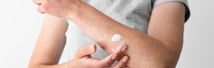 The Best Creams for Atopic Skin: Which Ones to Use?