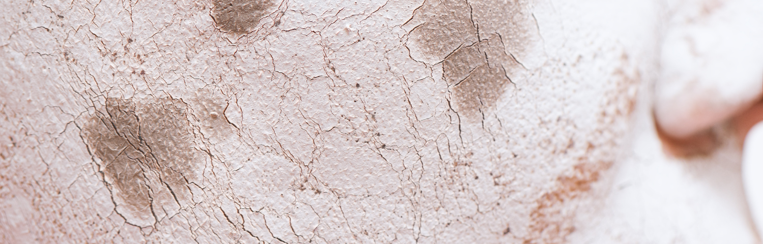 The Dreaded Skin Dark Spots: We Help You from Your Online Pharmacy