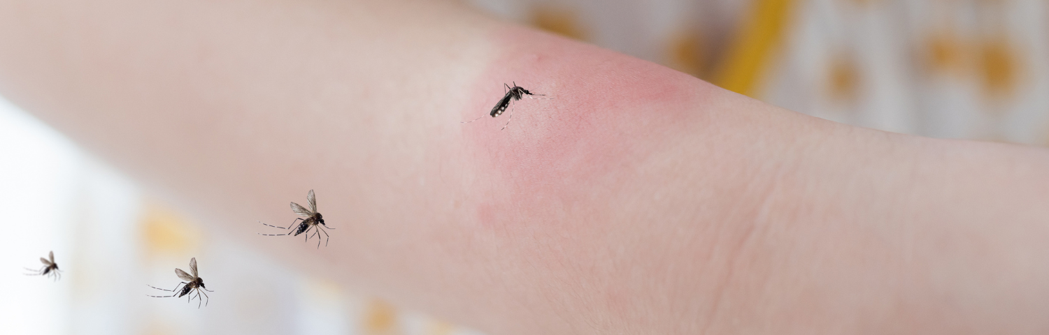 How to soothe a mosquito bite