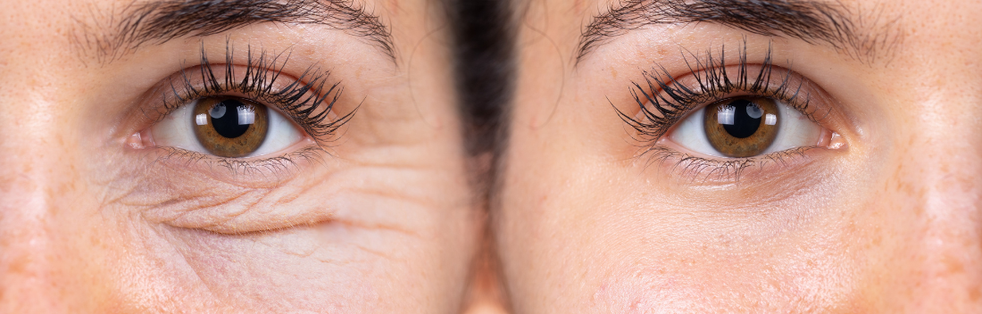 How to stimulate collagen production and improve the firmness and elasticity of the skin