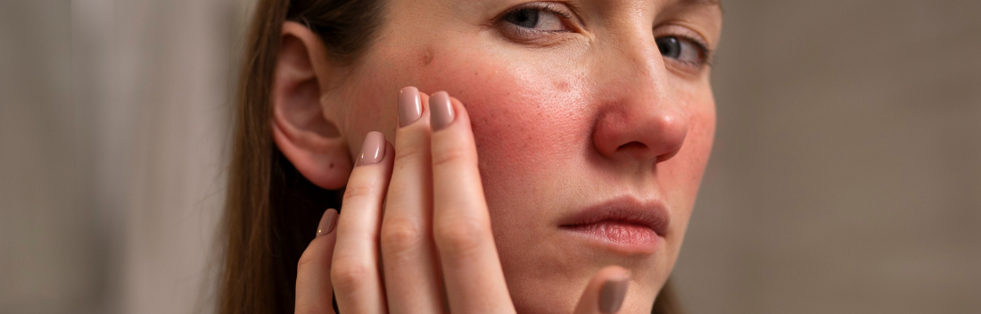 Reactive and sensitive skin: what it is, causes and treatment