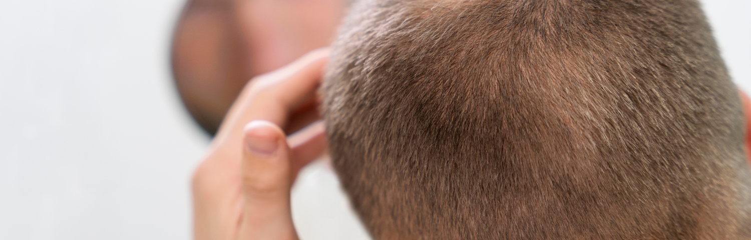The best anti-hair loss treatments and how they help strengthen it