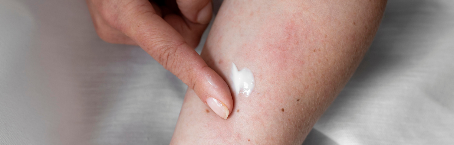 Seborrhoeic Dermatitis on the Face: What It Is, Causes and Treatment