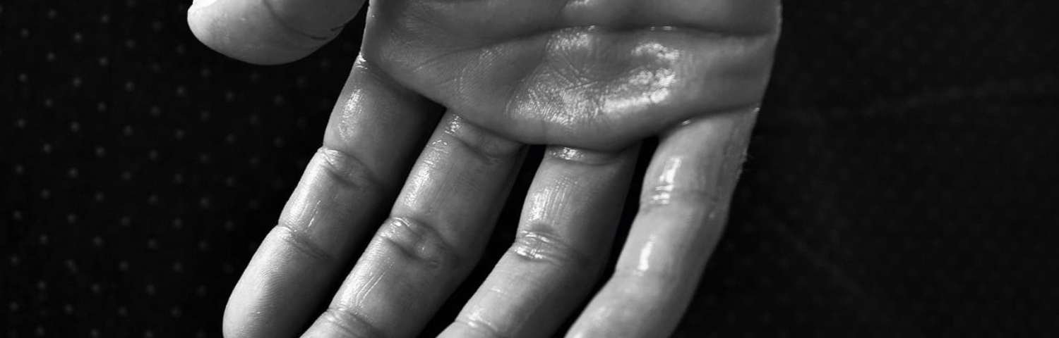 What Is Hyperhidrosis and How Do I Know If I Have It?