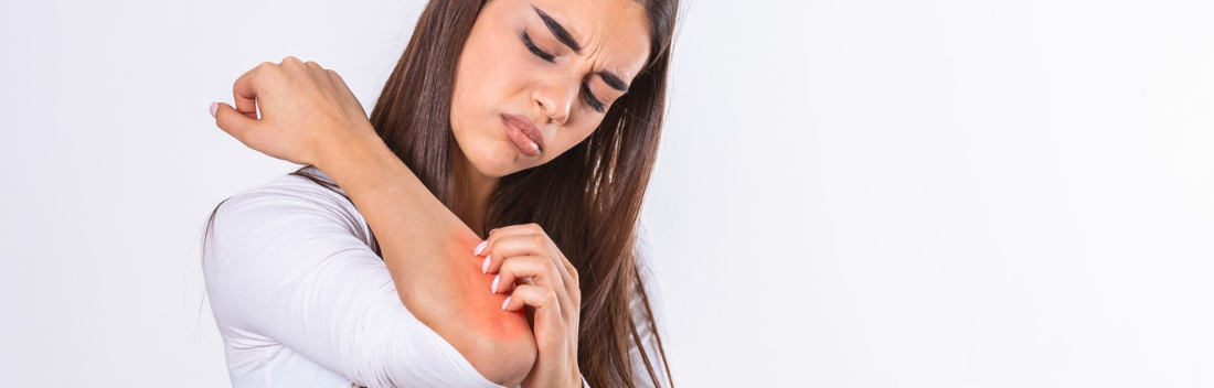 How to care for atopic skin