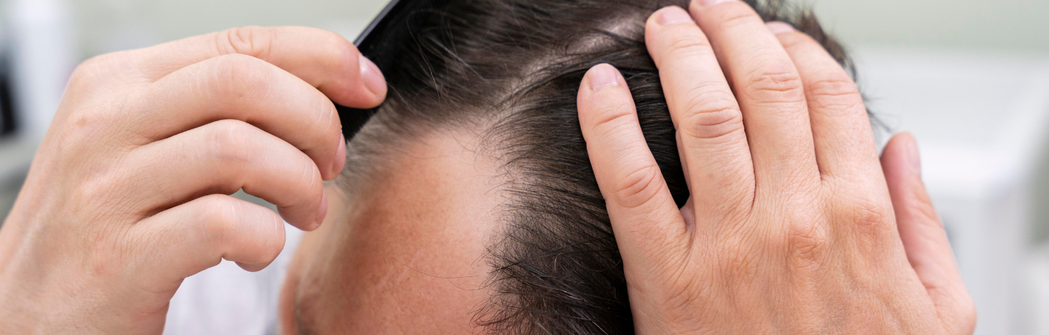 Best Hair Loss Ampoules for Women
