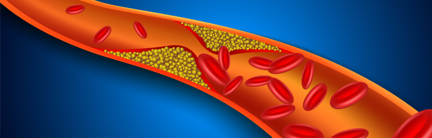 Which cholesterol is the good one?