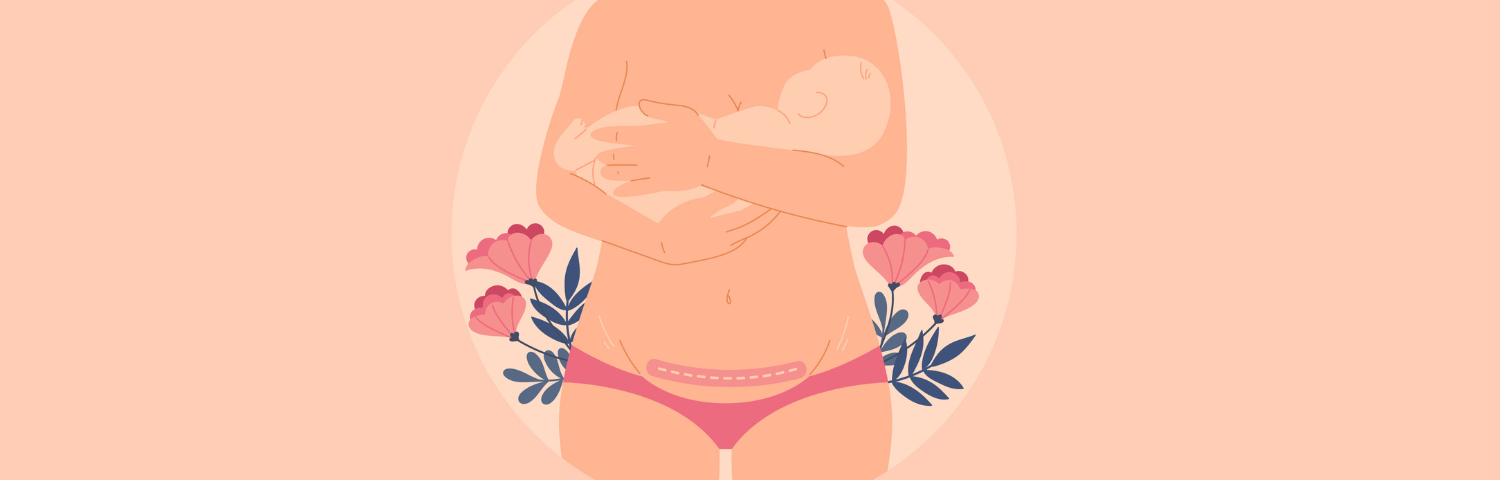 Types of caesarean sections and scars