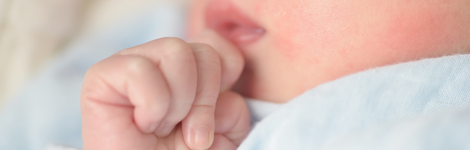 Allergy in babies: symptoms and causes