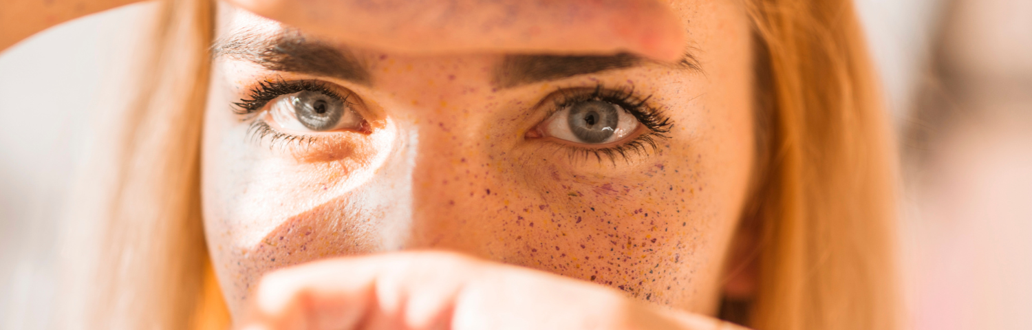 How to Protect Sun Spots, Moles and Freckles
