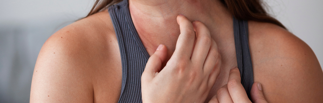 What can I do if I get pimples during treatment