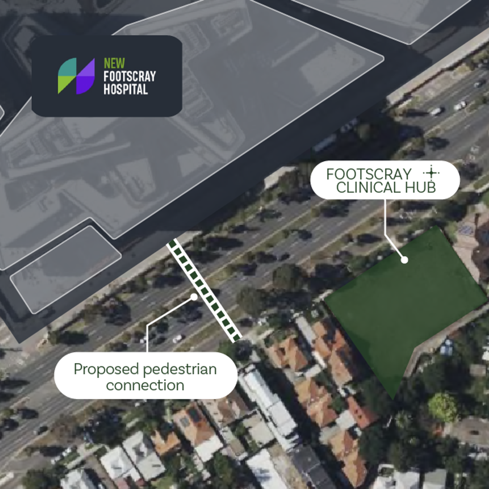 Footscray hospital