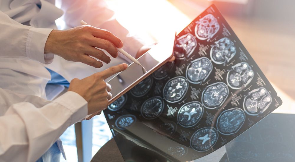People in doctor's coats examine MRIs while looking at an iPad.