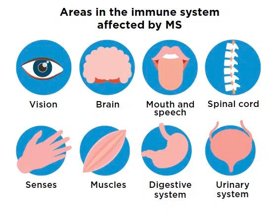 Chart showing the areas in the immune system affected by MS