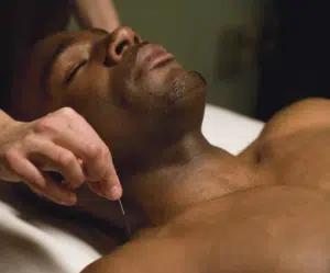 Black man receiving acupuncture therapy