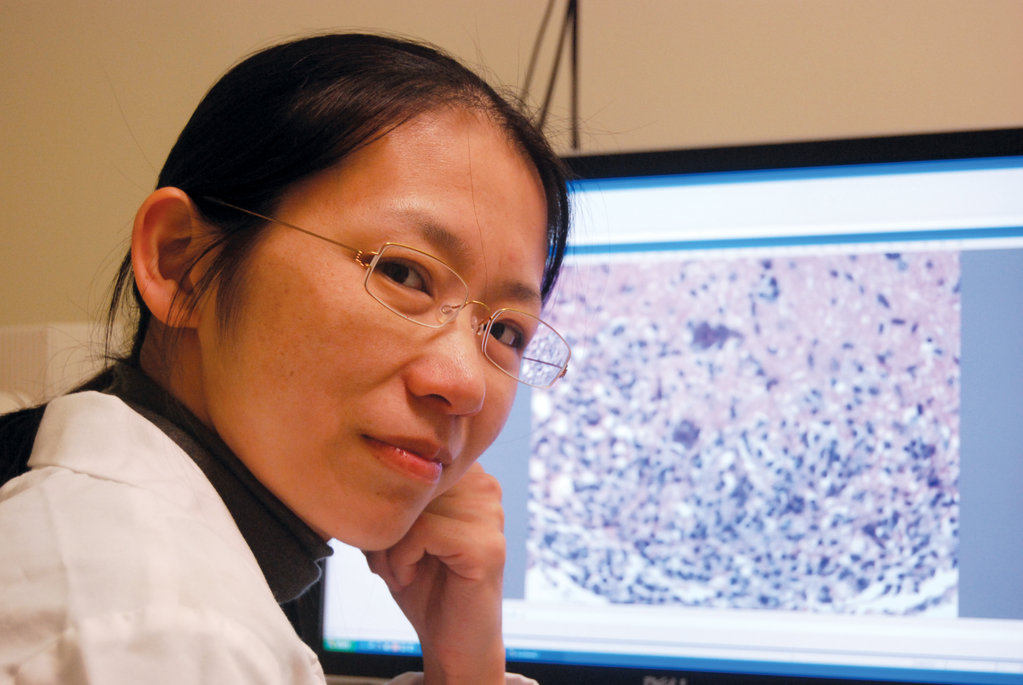 A young woman in a white coat with glasses rests her head on her left hand in front of a monitor