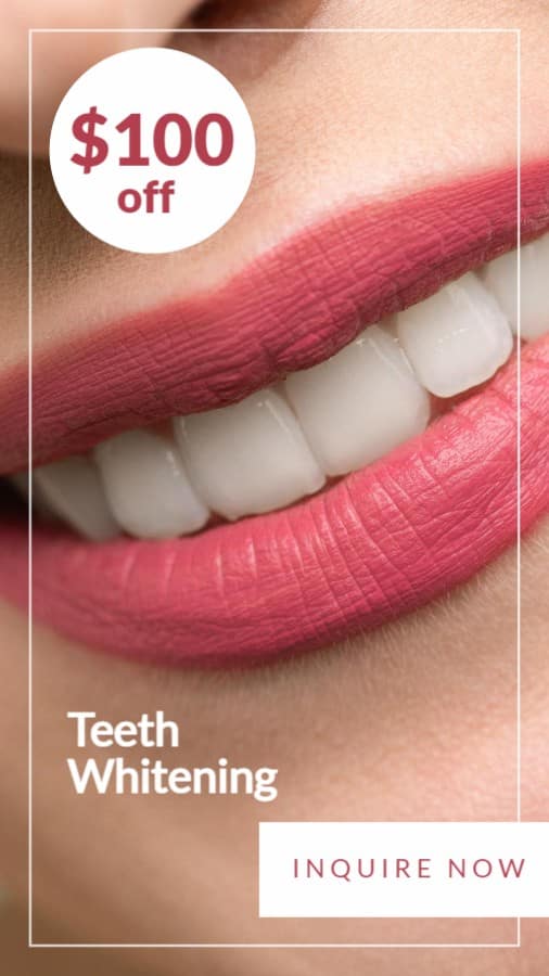 Teeth Whitening Special