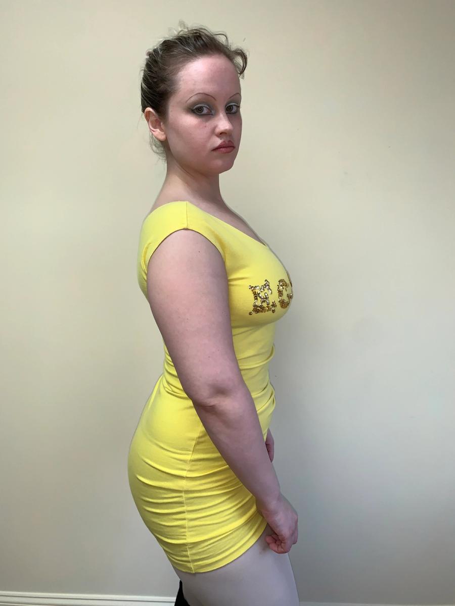 Hysteric Glamour "Ecstasy" Bodycon Dress product image