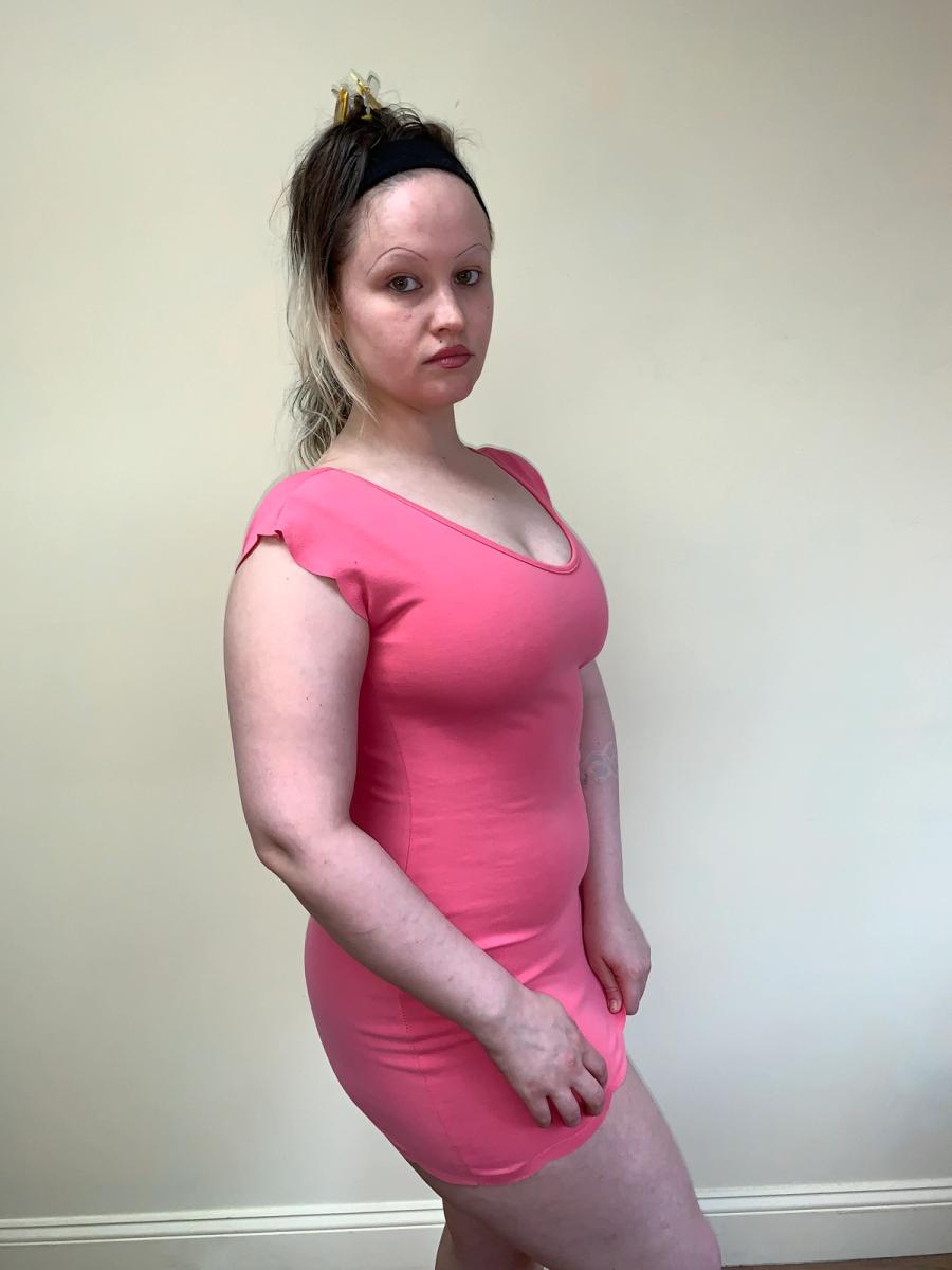 Vivienne Westwood Scalloped Minidress product image