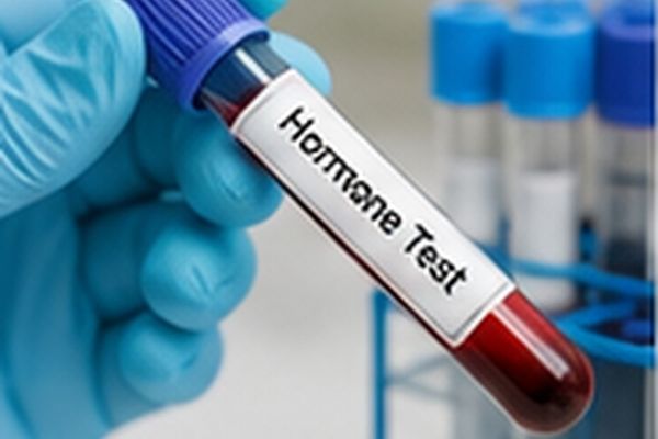 Hormonal Health Blood Test