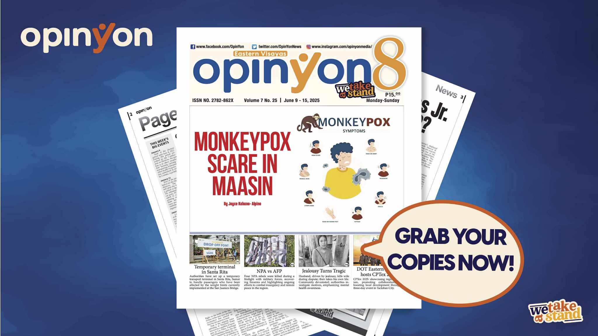 Monkeypox scare in Maasin