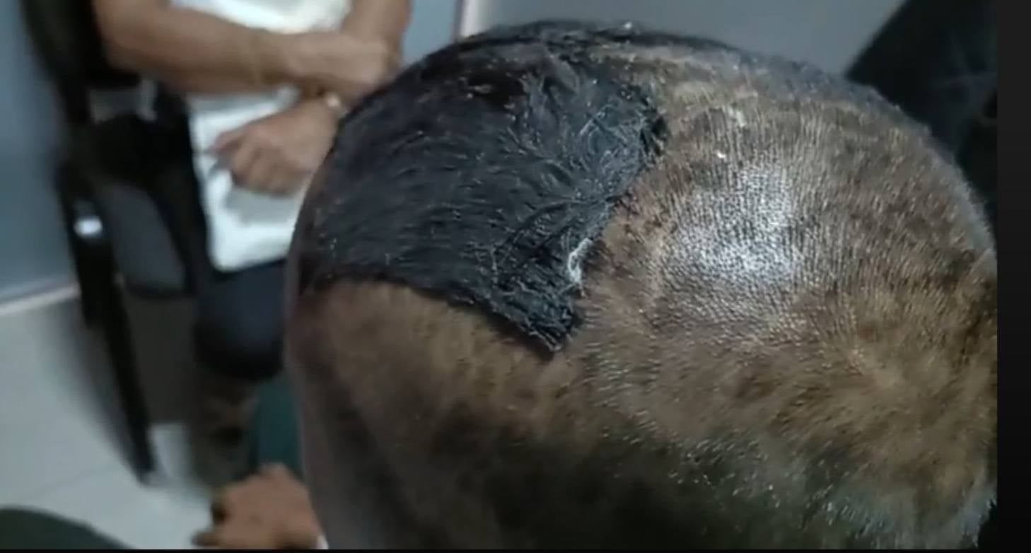 A case of police abuse in Tacloban 