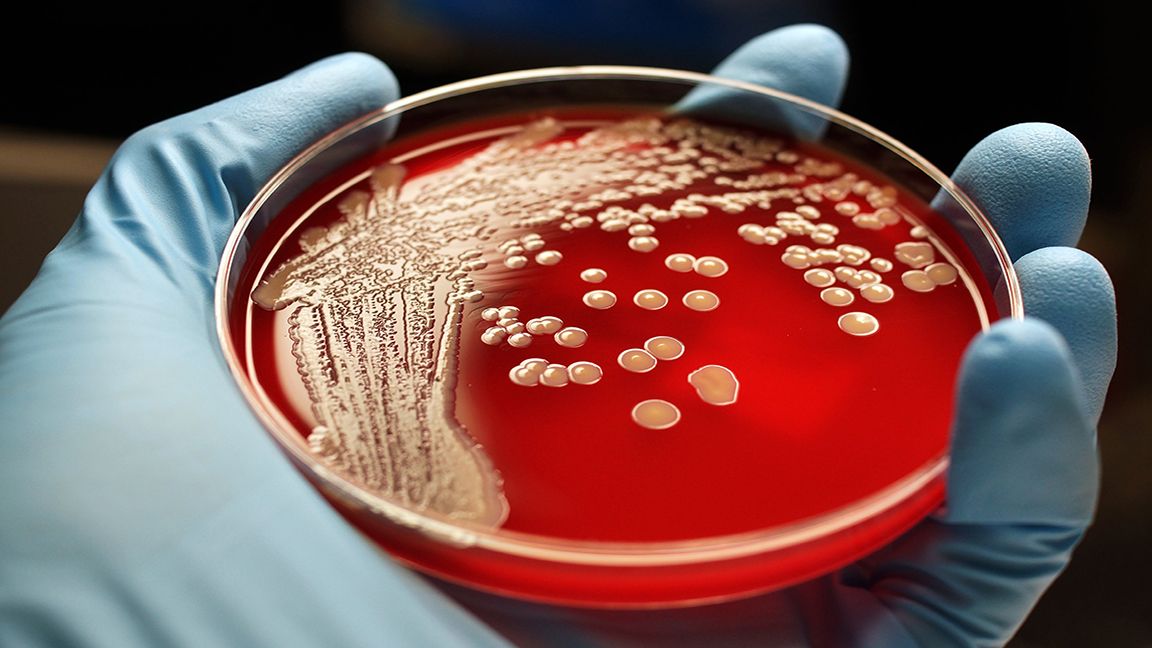 More risks for travelers; superbugs could be waiting for you