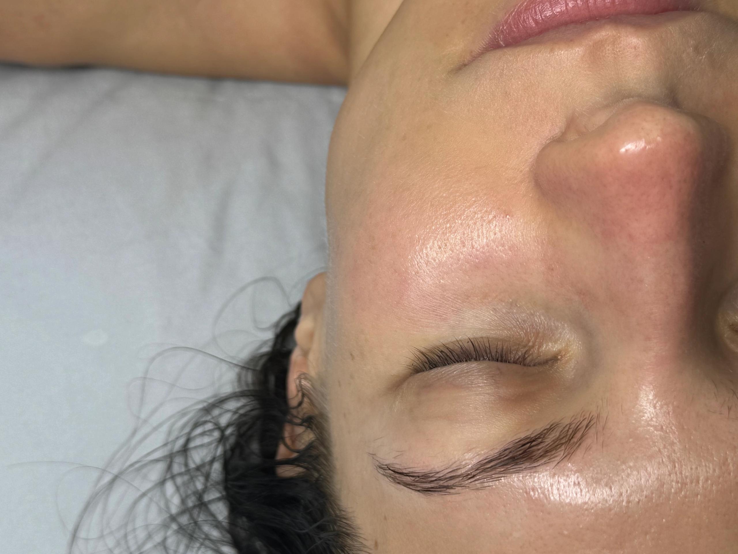 Close-up of a person's face with eyes closed, showing smooth, glowing skin.