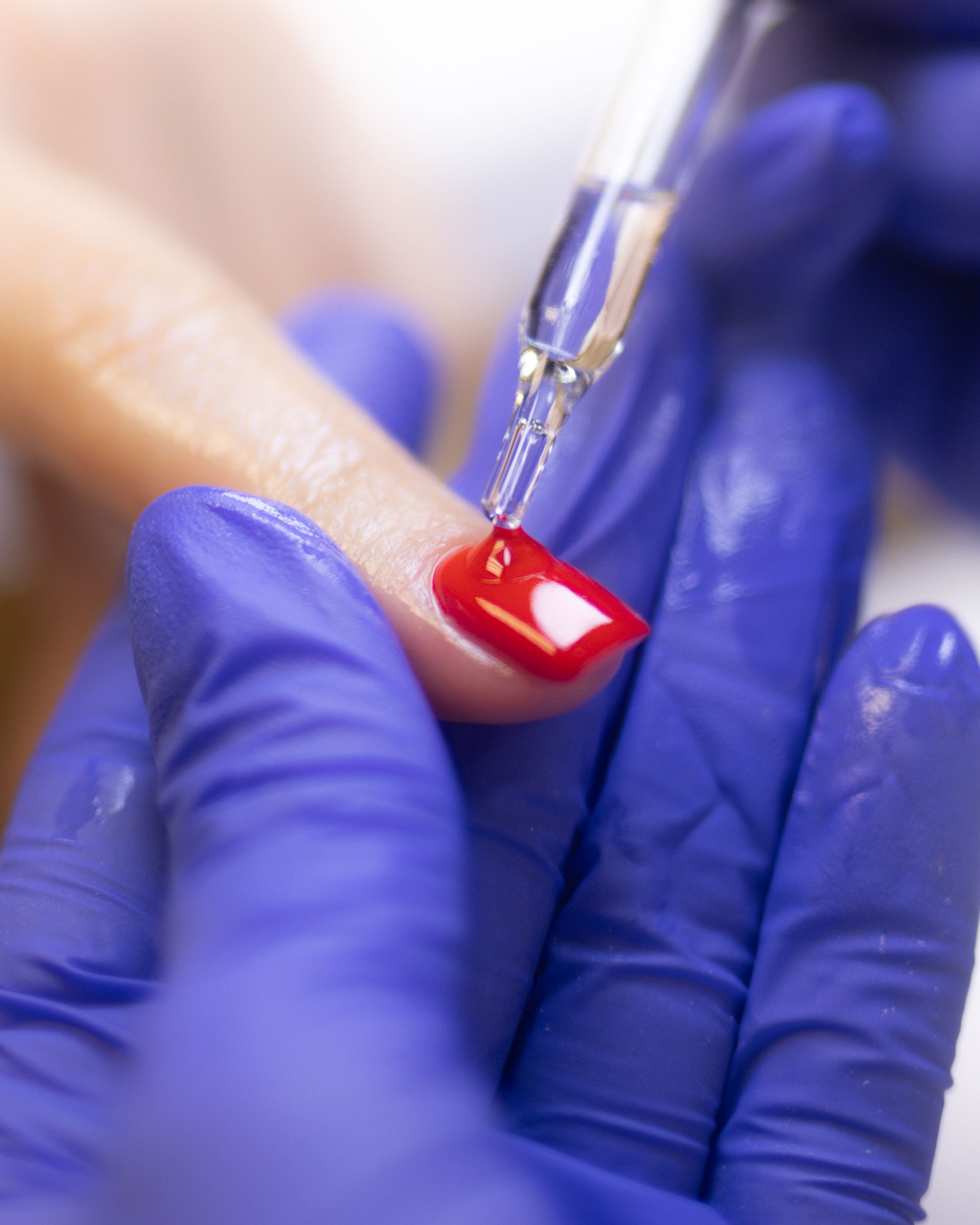 A gloved hand applies clear liquid with a dropper to a red-painted fingernail.