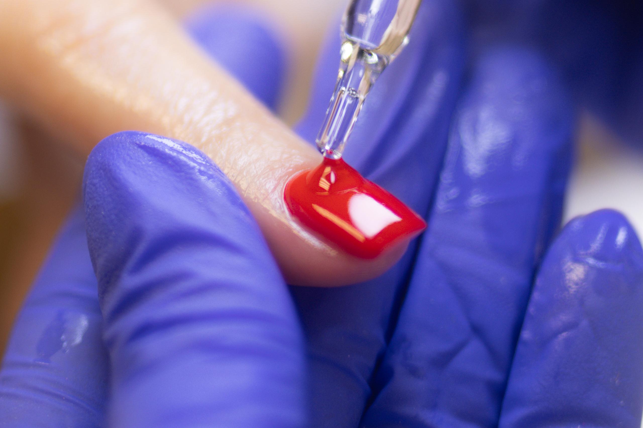 A gloved hand applies clear liquid with a dropper to a red-painted fingernail.