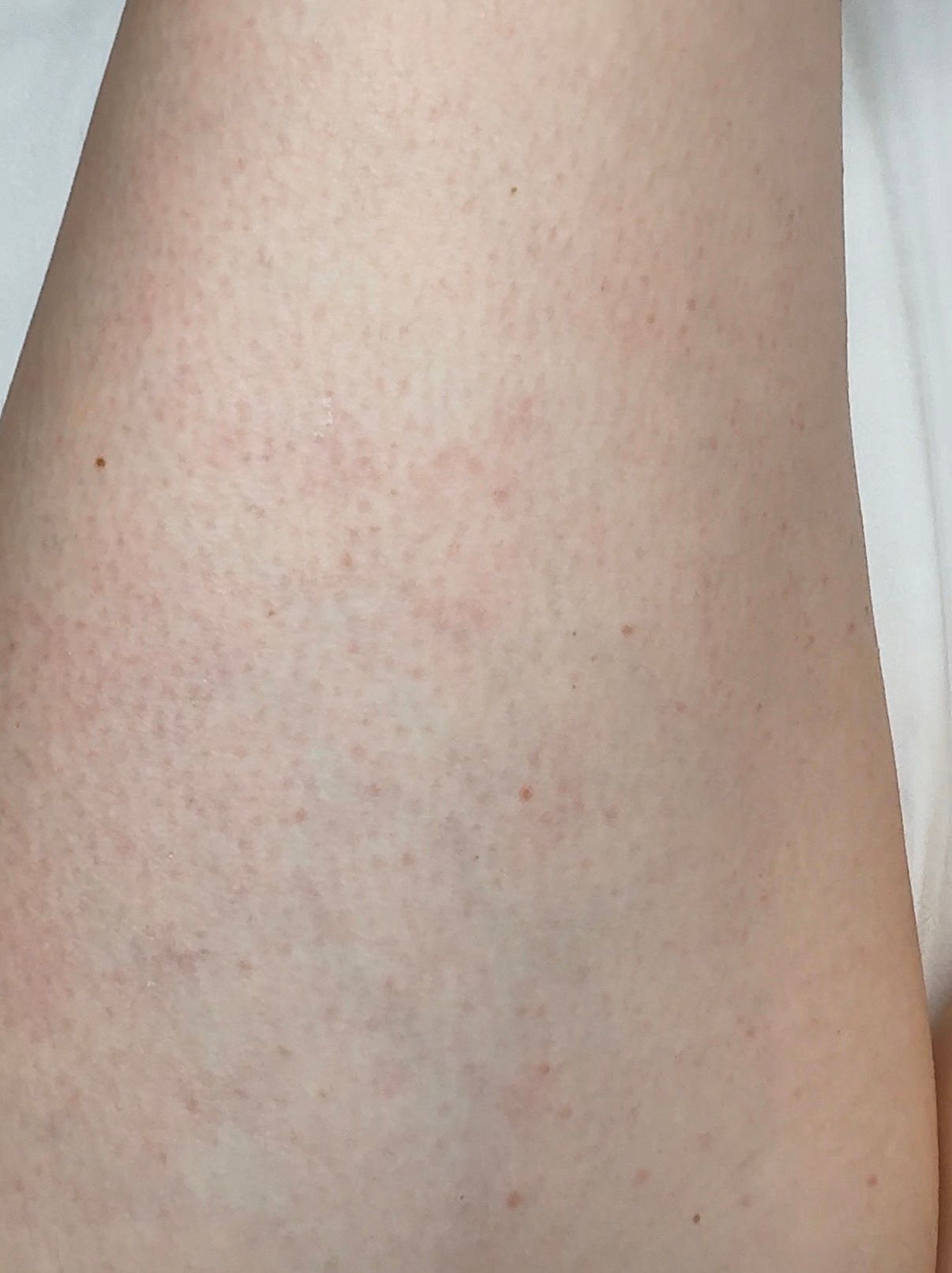 the upper part of a girl's leg