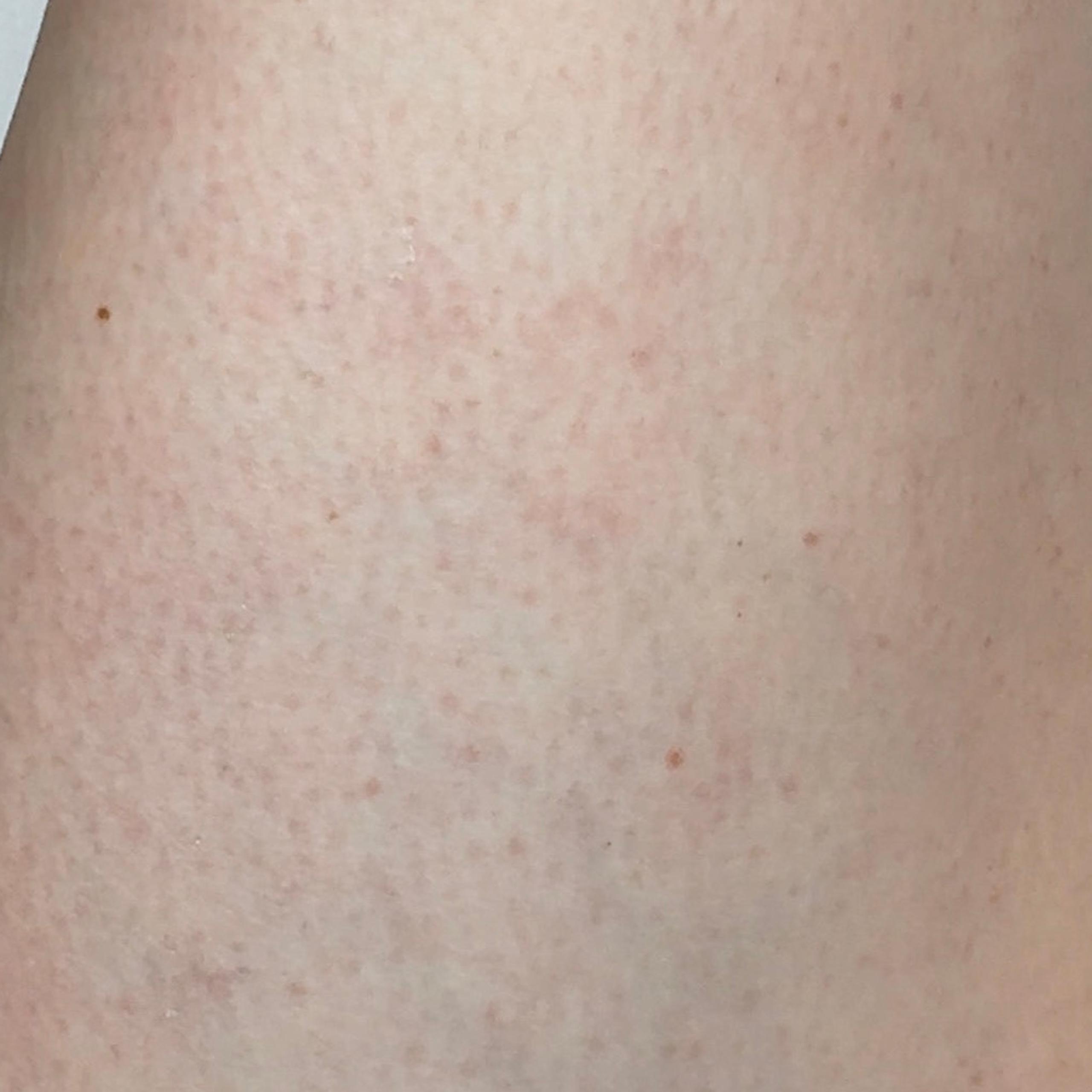 the upper part of a girl's leg