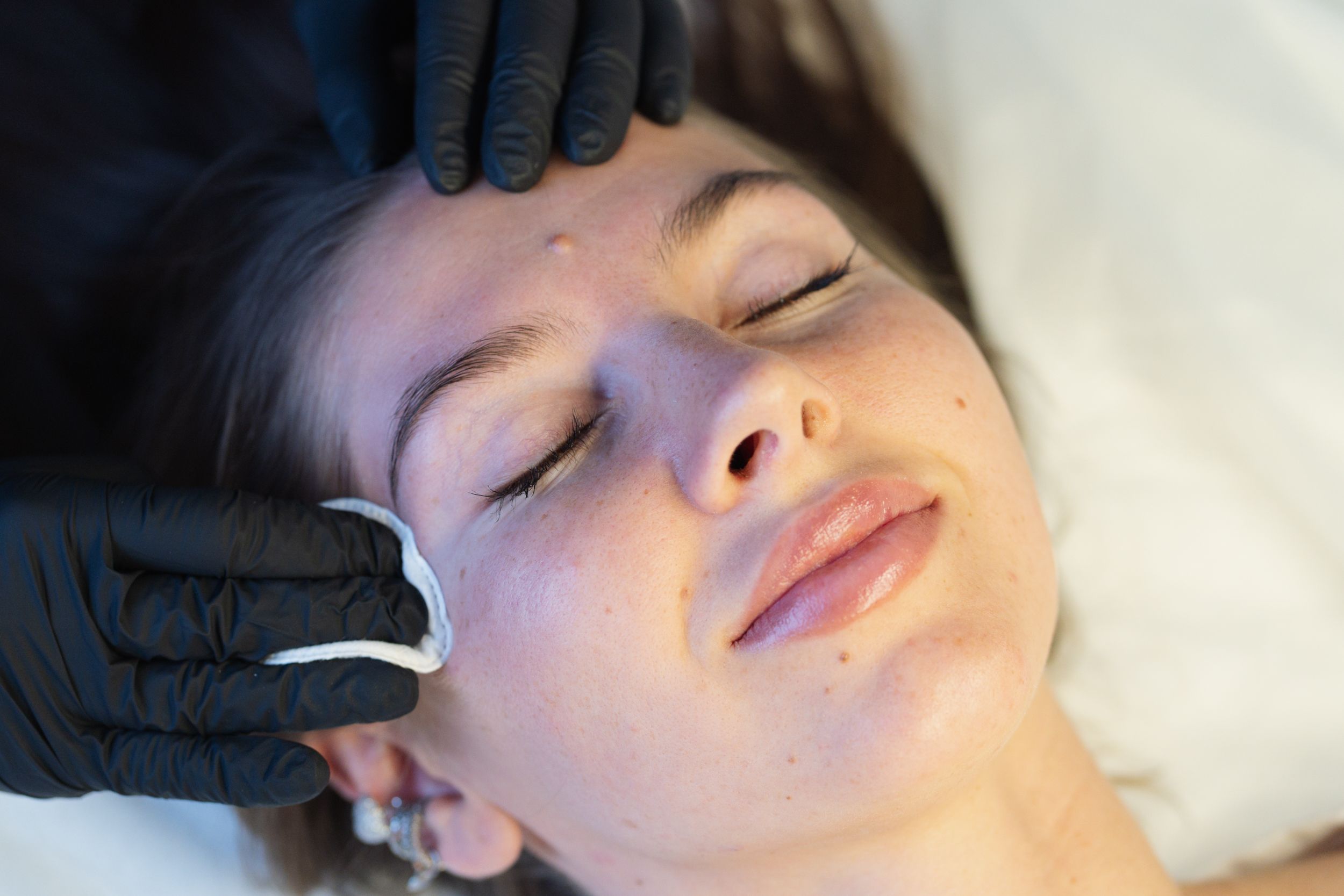 An esthetician wearing gloves cleanses a client’s skin with a cotton pad.