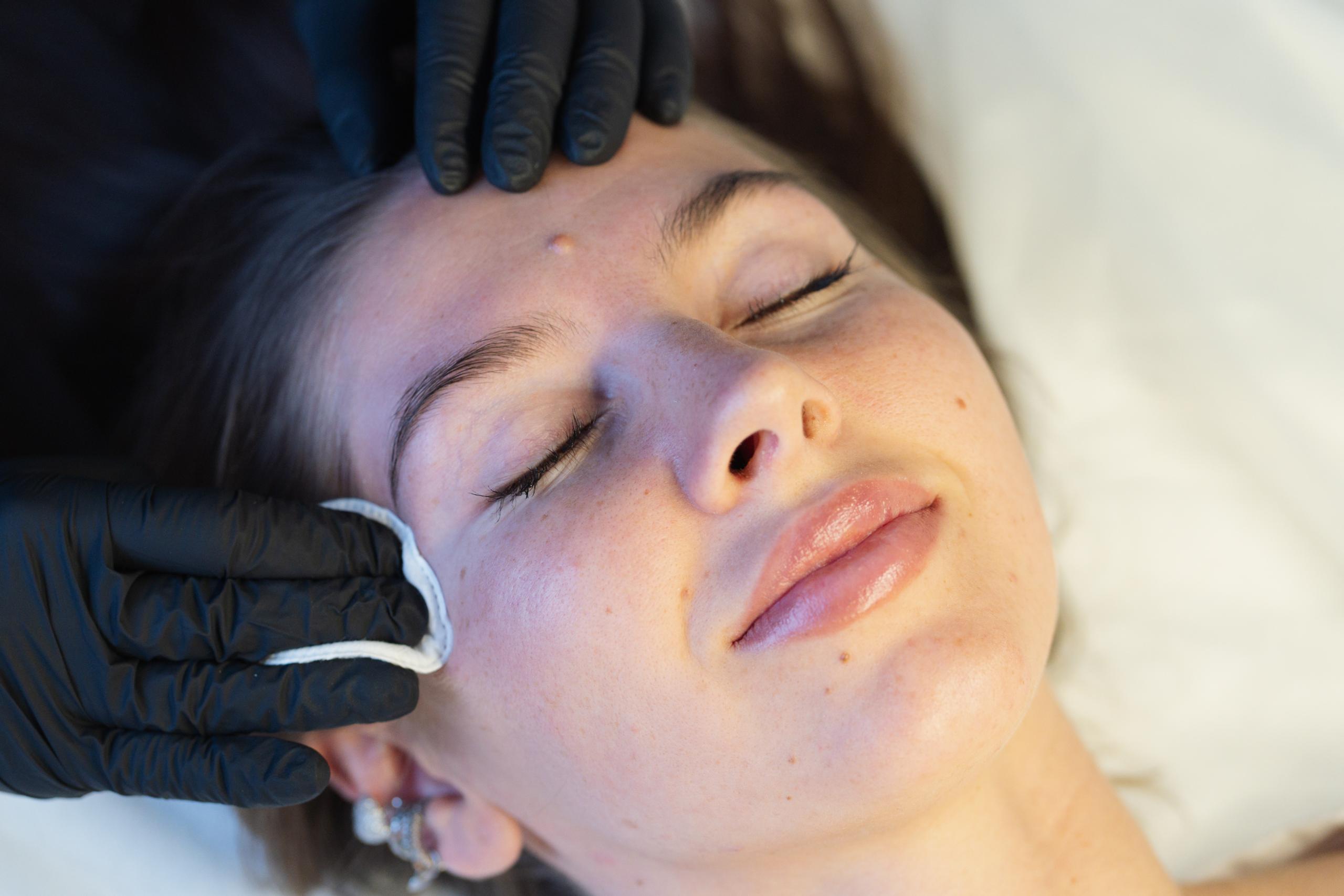 An esthetician wearing gloves cleanses a client’s skin with a cotton pad.