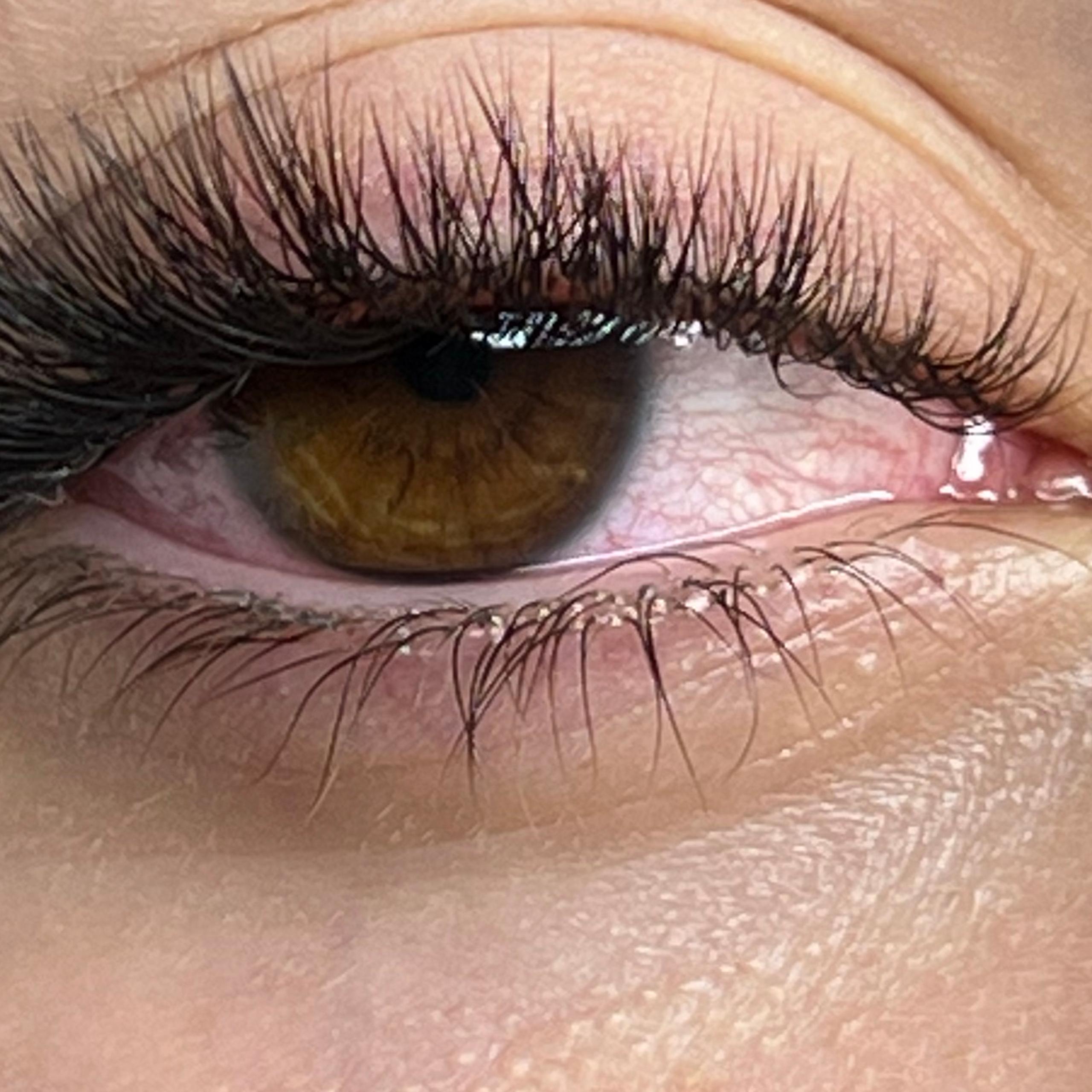 Close-up of a brown eye with thick, dark eyelash extensions and a full eyebrow; the eye appears red.