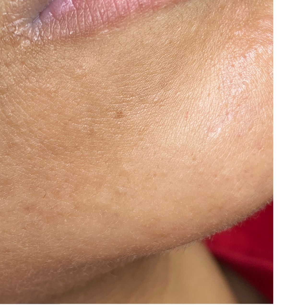 Close-up of the lower face, showing clear skin