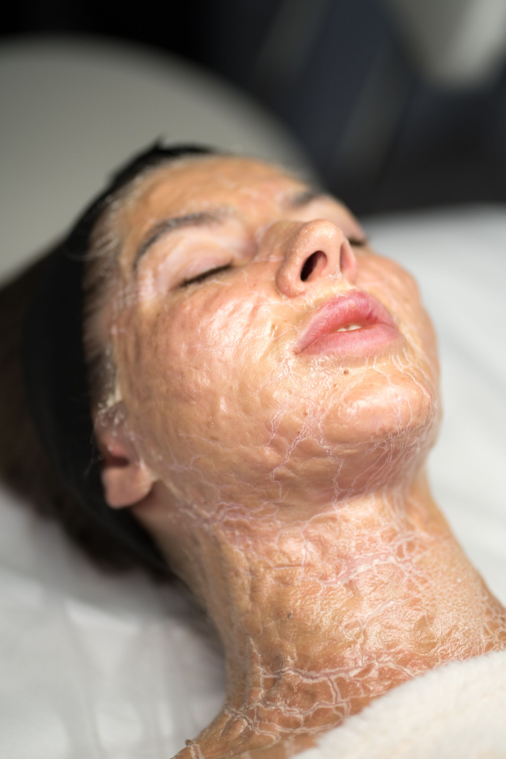 Woman with eyes closed, face and neck covered in a dry, cracked facial mask.