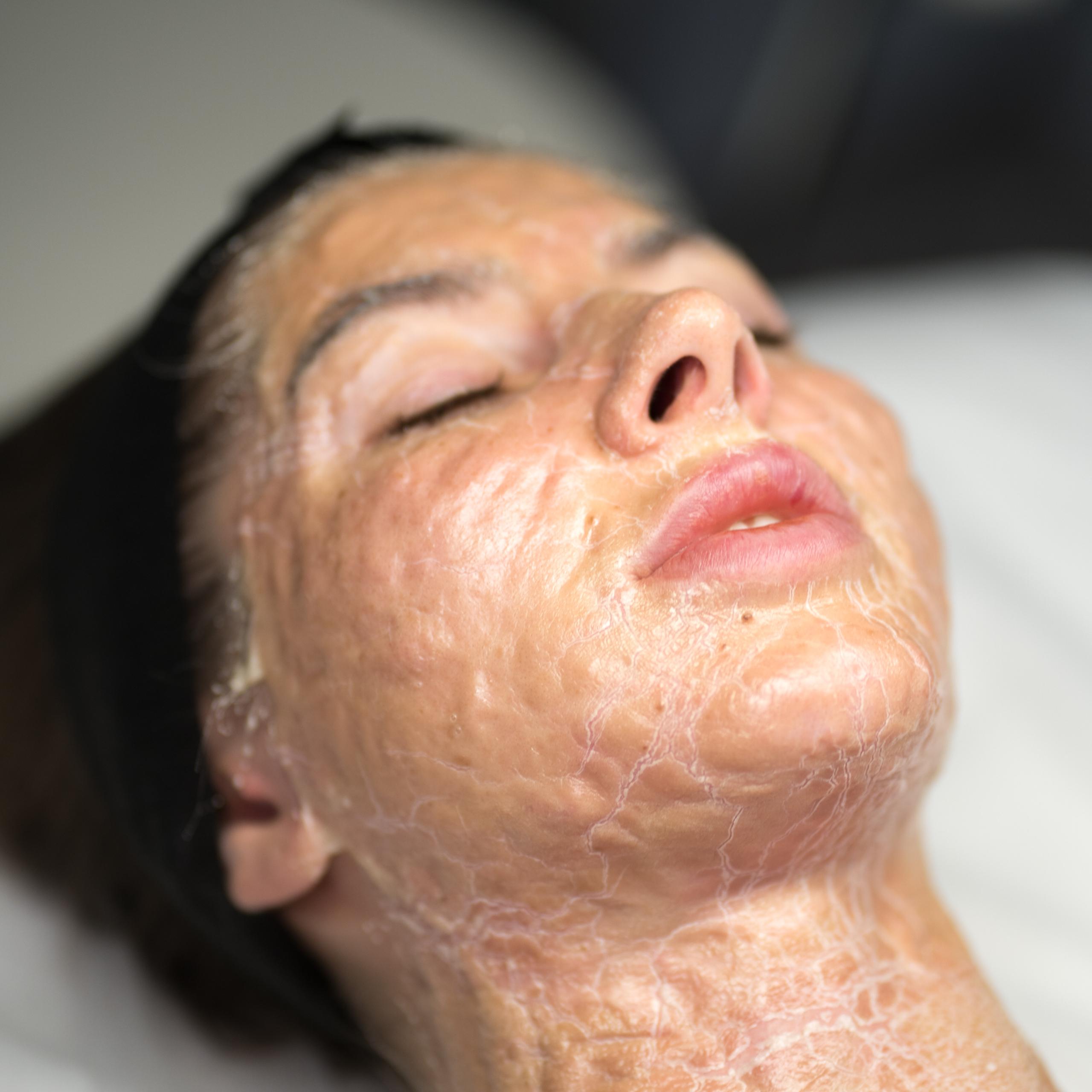 Woman with eyes closed, face and neck covered in a dry, cracked facial mask.