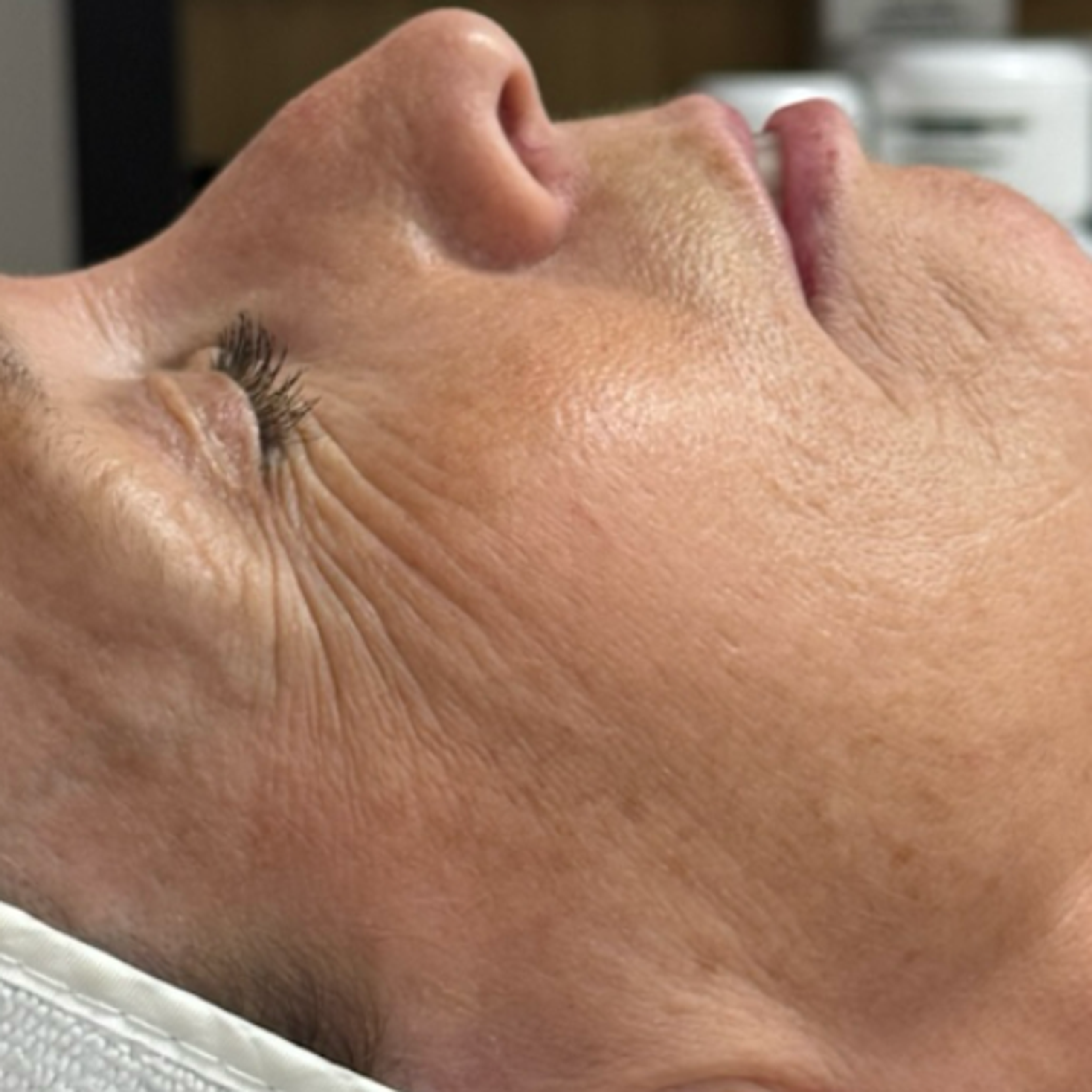 a woman's face, showing wrinkles around eyes and neck